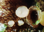 :-Bryoscyphus conocephali