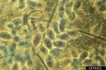 :-Trichothecium roseum